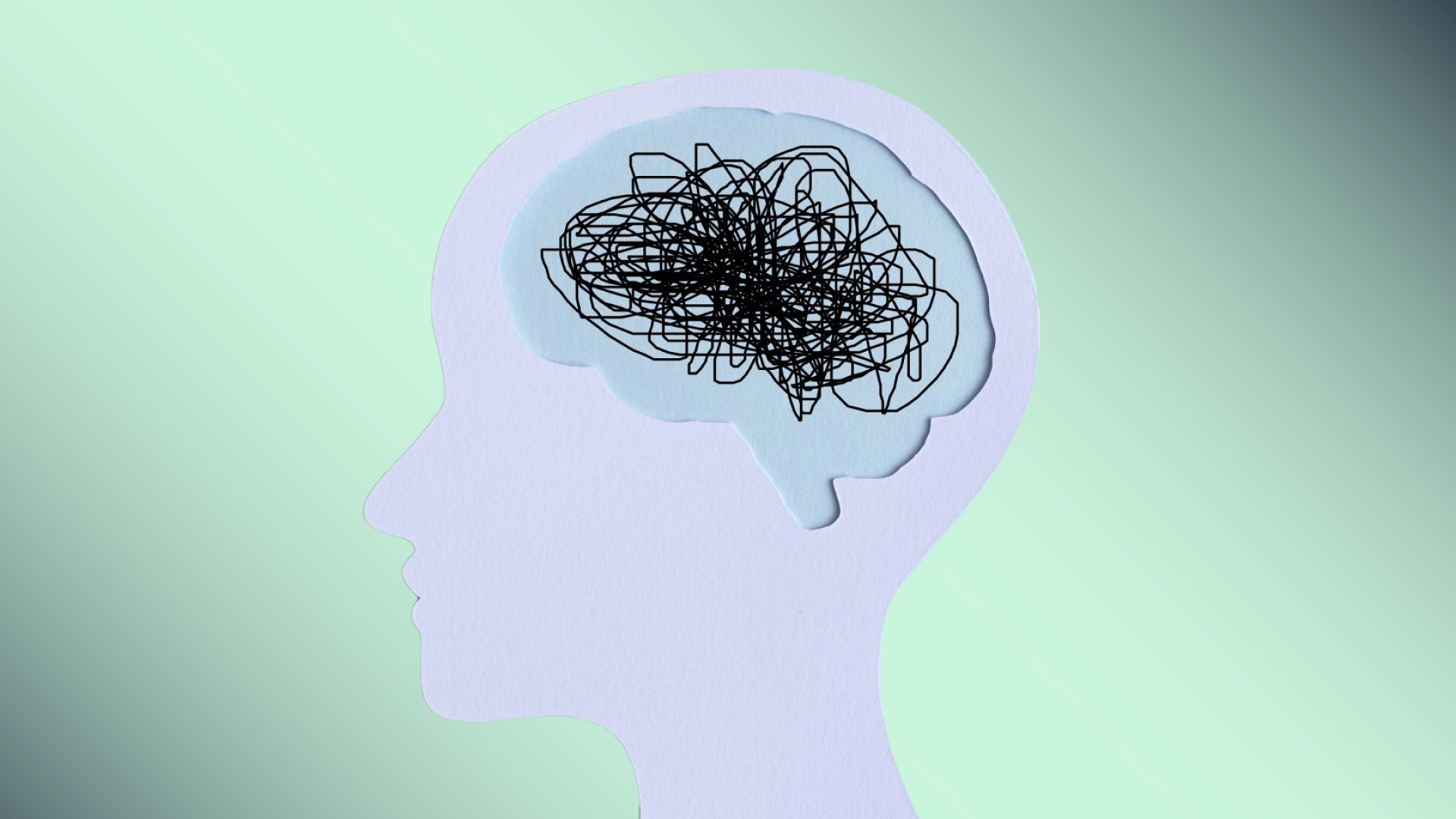 Bước Ngoặt Mới: Các Nhà Khoa Học Quan Sát Lo Âu Phát Triển Trong Não